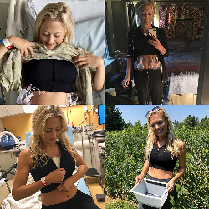 Collage of woman in a black surgical compression bra showing real post surgery recovery journey from hospital to daily life